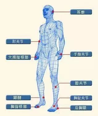 1.7亿国人中招，年轻人多发，春节更要当心！
